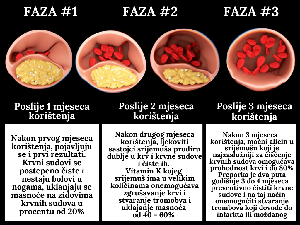 FAZA1 1